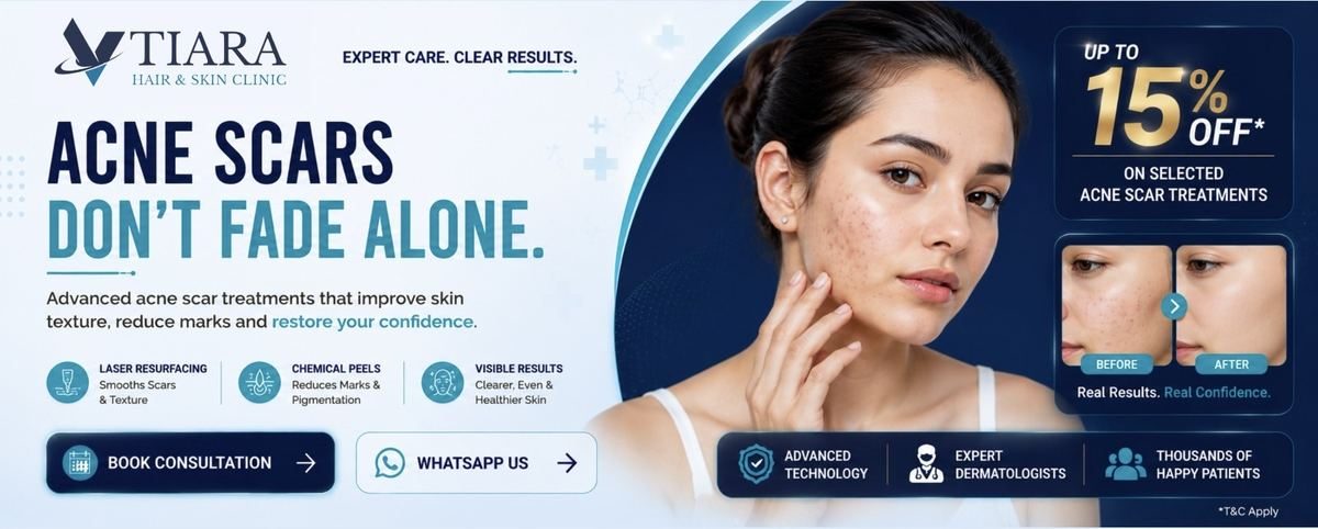 Clear Skin, Zero Pimples - Pimple Treatment in Bangalore at VTIARA